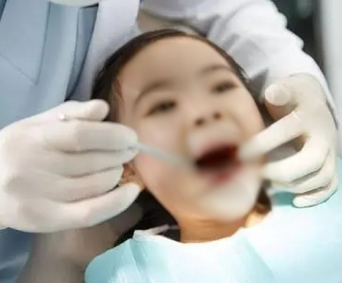 儿童牙齿矫正不重要？看完这篇你就知道了
