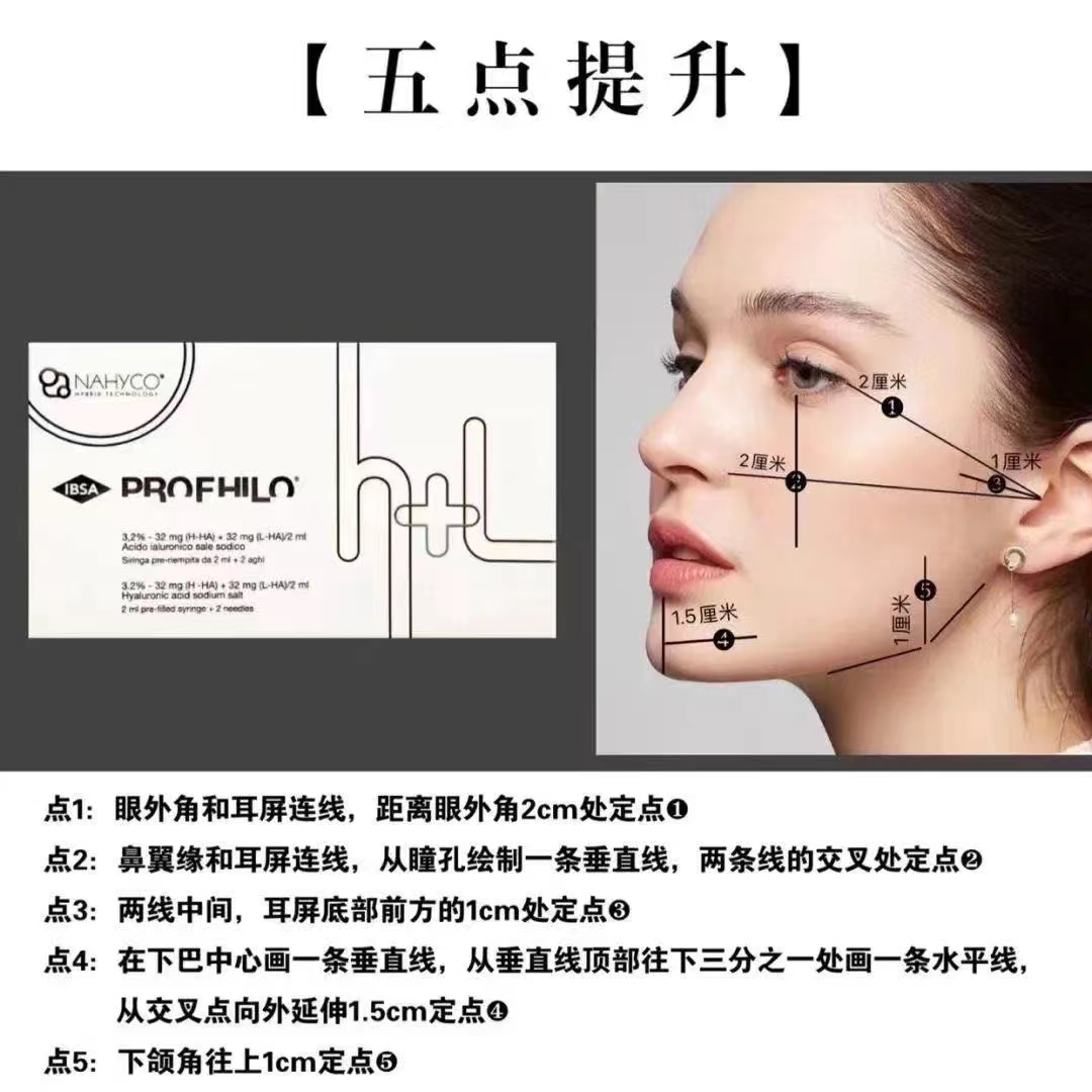 上海嘉定区微整形培训鼻背纹形成去除办法