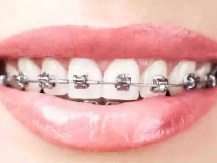什么情况下可以种植牙齿?