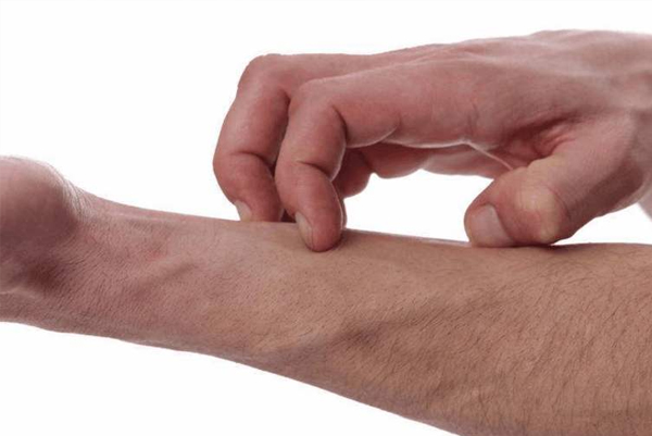 治疗皮肤瘙痒长垣皮肤病诊所提醒一定要对症下药