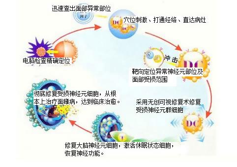 乌鲁木齐治疗面瘫，面肌痉挛，面肌抽搐的专科医院 新疆一建医院神经内科