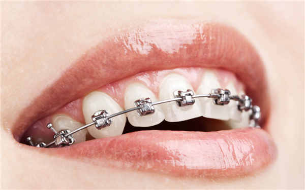 牙周-牙髓出现问题都有哪些症状