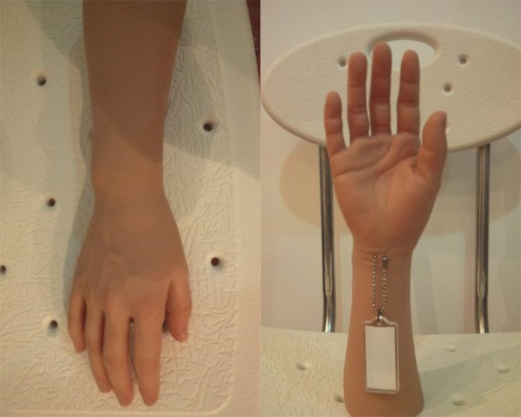 青州市 手指假肢的分类与安装
