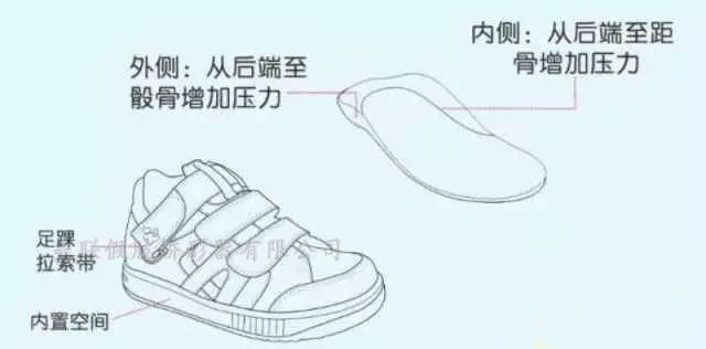 济南市会引起膝屈/膝过伸代偿性的变形，建议穿着矫正鞋托或矫正鞋，帮助对线站立及走路。