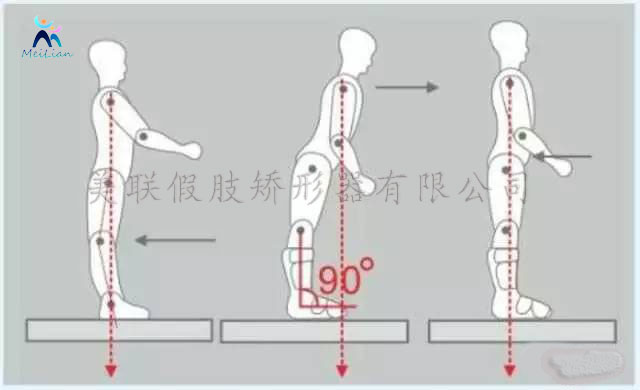 滕州市   矯正鞋包括全包裹式鞋、腳托鞋矯正鞋，可以糾正小朋友的嚴重扁平足和后足外翻。