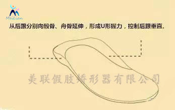 淄博市 什么是矫形鞋垫？简单的定义就是放在鞋里能够矫正和调节走路姿势的垫子。