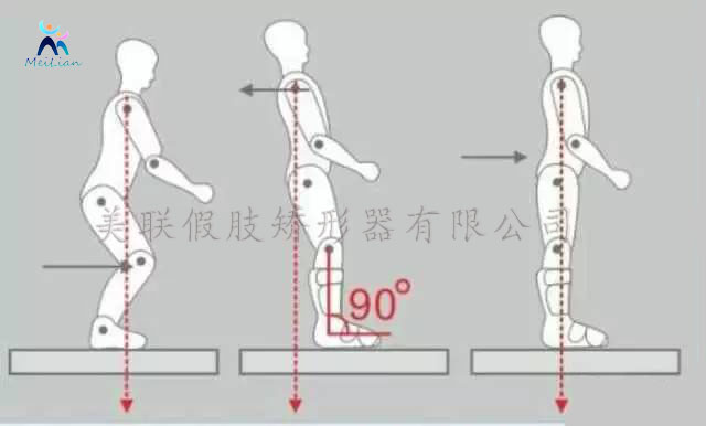 單 縣 兒童矯形鞋 矯形鞋廠家 兒童骨科專(zhuān)科醫(yī)生支持才可糾正，如矯正鞋、矯正支架。