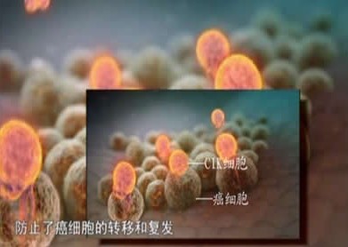 生物细胞免疫治疗让肿瘤患者带瘤生存不再是梦