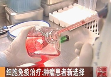 青岛市治疗肿瘤最好的医院推荐2013治疗肝癌新疗法