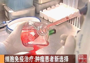 乳腺癌、粘液腺癌最佳治疗方案没有生物治疗怎么行