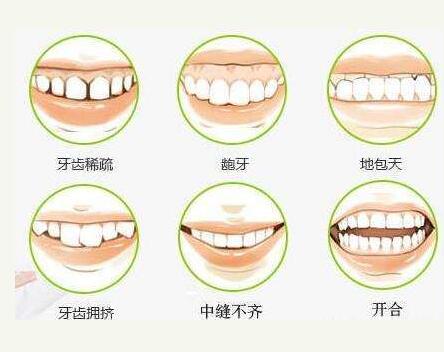 兰州牙齿矫正多少钱？