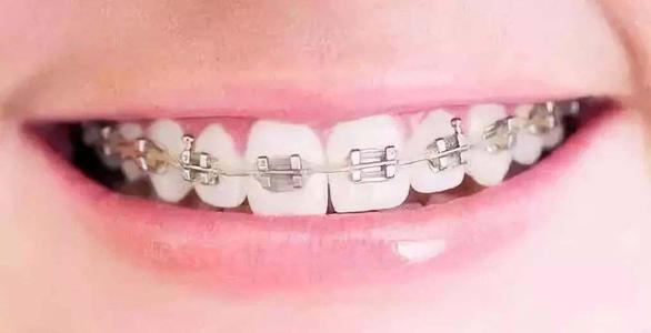牙齿矫正诊所-ms