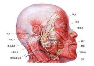 面神经麻痹怎么办？新疆乌鲁木齐友好医院医生为您解说