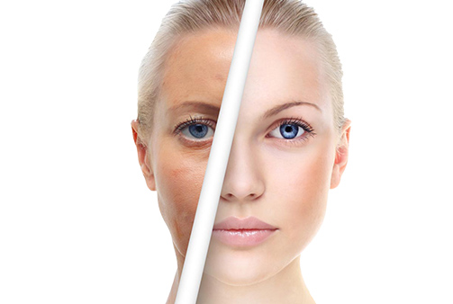 目前的皮肤美容光电疗法有哪些？