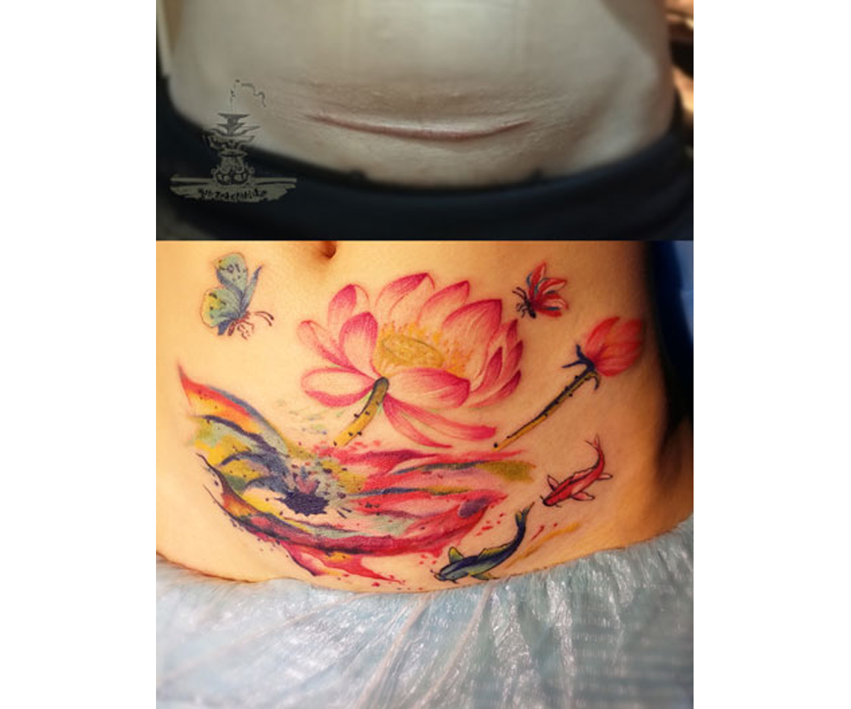 北京遮盖纹身我见过最美的纹身是在伤口上