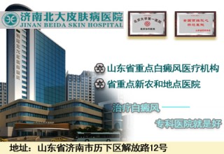 山东白癜风治疗首选医院