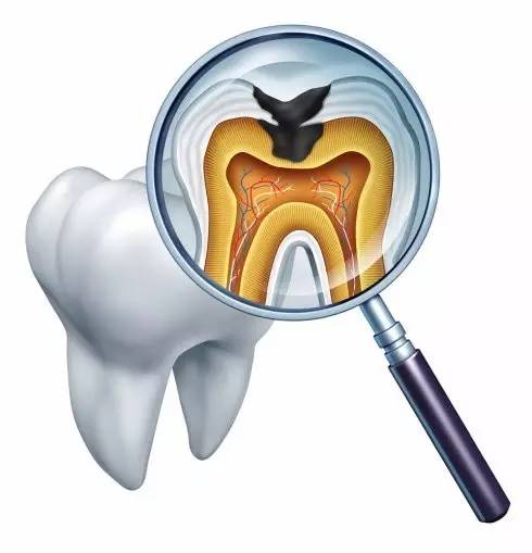 兴安盟誉达口腔医院常识为什么补牙不能一次完成呢
