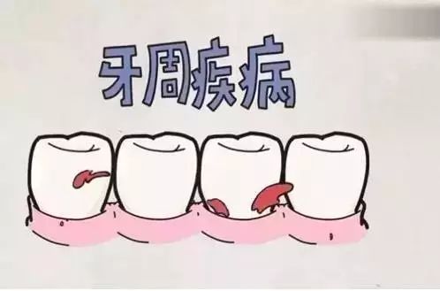 乌兰浩特牙周治疗 牙周疾病预防 誉达口腔医院 关爱牙齿