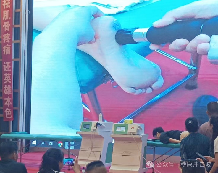 體外沖擊波vs傳統(tǒng)療法：哪種更適合您的足底筋膜炎？